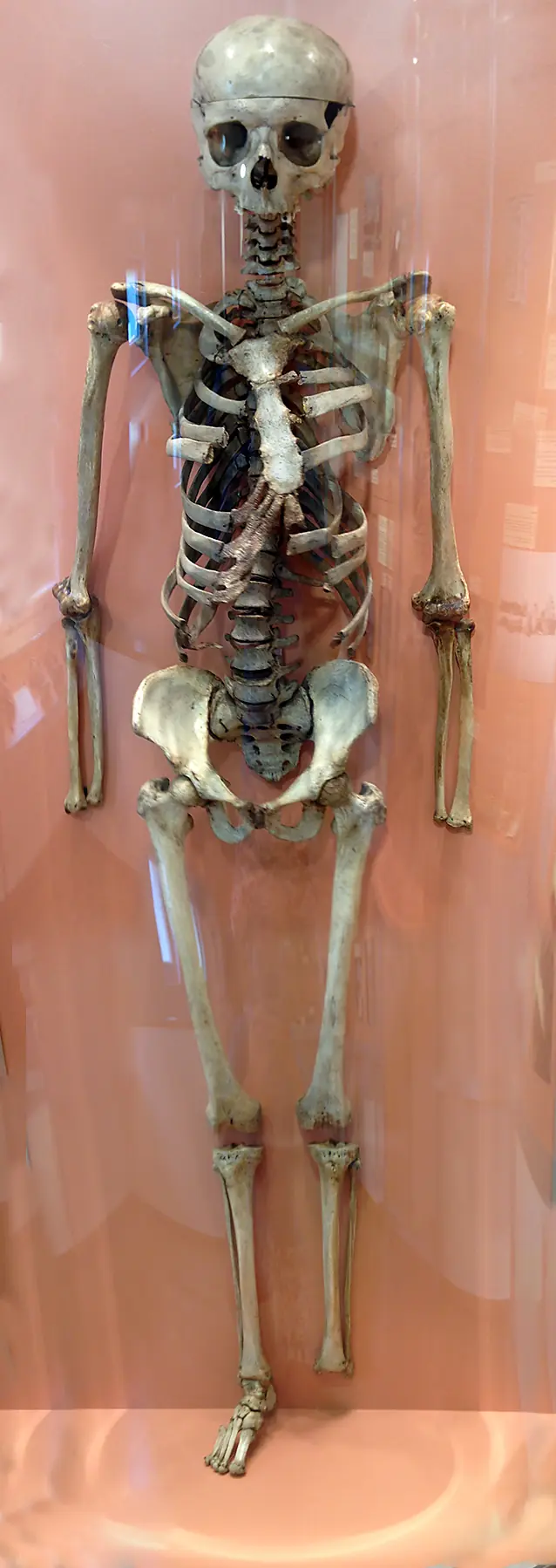 Moartea lui Vesalius, moștenirea anatomiei moderne — Brussels, Spanish Netherlands (now Belgium)